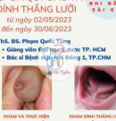 CÁC DỊCH VỤ CHUYÊN KHOA : CẮT DÍNH THẮNG LƯỠI, NONG HẸP- DÍNH BAO QUI ĐẦU- ĐỐT CHỒI RỐN...