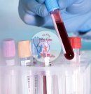 LIÊN KẾT XÉT NGHIỆM TT XÉT NGHIỆM TẠI TPHCM 